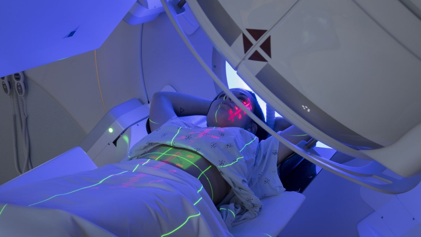 Using the Deep Inspiration Breath Hold Technique for Radiation Therapy